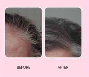 เซรั่มบำรุงผมปิด<span class=keywords><strong>ผม</strong></span>ขาว สูตรเฉพาะ ฟื้นฟูสี<span class=keywords><strong>ผม</strong></span>ธรรมชาติ เพิ่มความเงางาม เสริมความแข็งแรงให้ราก<span class=keywords><strong>ผม</strong></span>และหนังศีรษะ ชะลอการเกิดผมขาว - Product Image 2