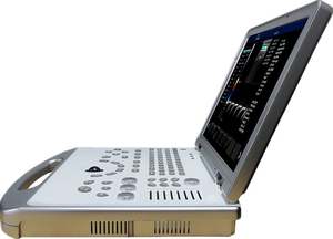 Prix de la machine à ultrasons portable Scanner à ultrasons portable sans fil à ultrasons 4d - Product Image 2