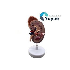 Modelo de Riñón con Glándula Adrenal - Herramienta Educativa de <span class=keywords><strong>Nefrología</strong></span> - Product Image 1