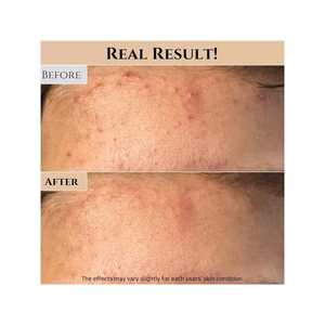 Masque éclat au riz moulu et au miel 150ml Crème exfoliante pour le visage - Product Image 2