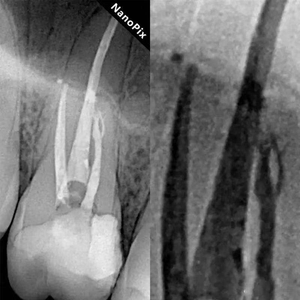 Capteur de radiographie portable avec zone active 24x33, interface USB sans fil, radiographie numérique RVG, capteur de radiographie - Product Image 5