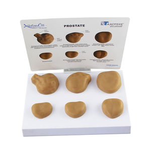 Modèle de <span class=keywords><strong>prostate</strong></span> pathologique ZM2061 22.5*16*2.5 - Product Image 1