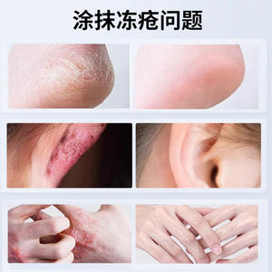 Crème hydratante anti-gerçures pour les mains et les pieds, usage général, pour peaux sèches - Product Image 4