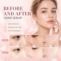Appareil professionnel d'infusion magnétique pour soins de beauté, non invasif, pour le visage, avec capsules d'extraits végétaux, en plastique, UE/Royaume-Uni