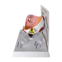 Modèle d'anatomie de l'œil humain Conditions de la cornée en PVC pour l'éducation médicale pour les écoles et les hôpitaux