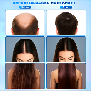 Hot 5 en 1 appareil de Diagnostic de la peau croissance des cheveux cuir chevelu Massage thérapie Machine follicule pileux Scanner dispositif analyseur de peau de cheveux - Product Image 6