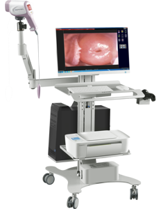 女性用ミニデジタルカメラビデオコルポスコープ - Product Image 4