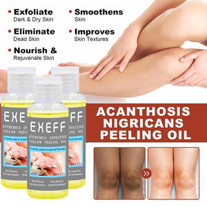 OEM Thêm sức mạnh Vàng lột da dầu hữu cơ Vàng lột dầu cam tẩy trắng dầu - Product Image 6