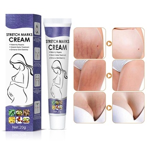 Crème Anti-Vergetures Post-Partum aux Herbes Chinoises Oem pour l'Abdomen, les Cuisses, les Jambes, les Fesses et la Poitrine, Crème de Soin Éliminant les Vergetures de Grossesse - Product Image 4