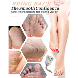 Herramienta Profesional <span class=keywords><strong>de</strong></span> Pedicura con Piedra Pómez <span class=keywords><strong>de</strong></span> Lava Natural para el Cuidado <span class=keywords><strong>de</strong></span> los Pies, Exfoliante para Piel Dura y Callosidades - Product Image 2