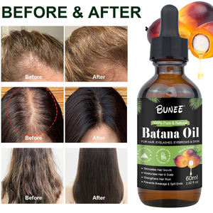 Aceite de Batán 100% Puro, Orgánico y Natural para el Tratamiento del Cabello Dañado, Aceite de Batán Crudo para el Crecimiento Capilar - Product Image 4