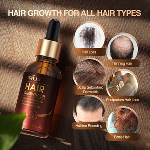 Traitement de la <span class=keywords><strong>calvitie</strong></span> pour <span class=keywords><strong>homme</strong></span>, soin du cuir chevelu, réparation, sérum de thérapie, sermon, croissance des cheveux, tonique - Product Image 5