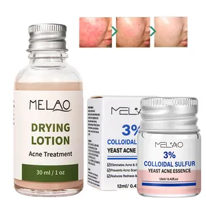 Essence d'acné de traitement de tache d'acné de contrôle d'huile de sauvetage rapide d'effet rapide avec 3% LEVURE DE SOUFRE COLLOIDAL