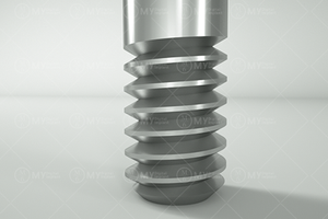 Sterkere Dlc Coating Ostem Tandheelkundige Implantaatschroef - Product Image 4