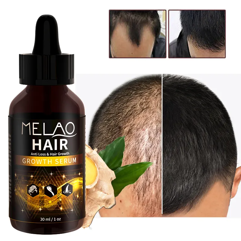 Hot Private Label Bulk Organic Vegan Hair Treatment Serum Wholesale Custom Herbal Anti Hair Loss Boosting Hair Growth Oil