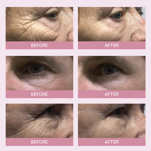 Crema <span class=keywords><strong>Contorno</strong></span> <span class=keywords><strong>de</strong></span> <span class=keywords><strong>Ojos</strong></span> Antiarrugas <span class=keywords><strong>de</strong></span> Marca Privada OEM con Retinol y Ácido Hialurónico, Masajeador Vibrador para una Hidratación Profunda y Reafirmante - Product Image 6