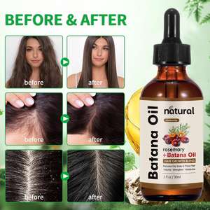 <span class=keywords><strong>Aceite</strong></span> de Batana Orgánico Natural y Tratamiento para la Caída del Cabello con Romero, Sérum para el Crecimiento del Cabello Totalmente Natural, <span class=keywords><strong>Aceite</strong></span> de Batana Crudo para el Recrecimiento del Cabello - Product Image 1