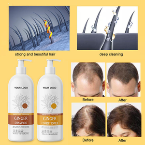 แชมพูสมุนไพรธรรมชาติแบบขายส่ง สำหรับผู้ชายและผู้หญิง สูตรขิงบำรุง ช่วยเพิ่มความชุ่มชื้น ป้องกันผมร่วง รับผลิตแบรนด์ส่วนตัว - Product Image 2