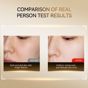 Siero Liquido Anti-Età con 377 Fiale di Niacinamide, Arbutina, Ialuronato di Sodio e Glicerina, Peptidi Anti-Rughe e Anti-Lentiggini per il Viso - Product Image 4