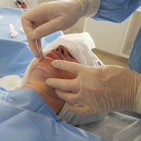 2024 Offre Spéciale meilleur prix machine lipolyse 980nm diode laser physiothérapie pour l'amincissement du corps