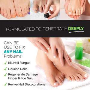 Traitement pour les ongles, accessoire de pédicure pour les pieds et les orteils, traitement pour les doigts et les orteils, Nail-art, 120 pièces - Product Image 4