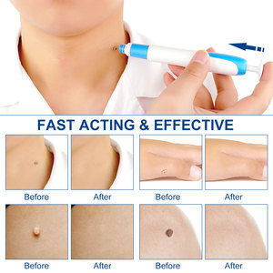 Organic Skin Tag and <strong>Wart</strong> Auto Removal Pen Effective Genetic <strong>Wart</strong> Removing Tool - Product Image 5