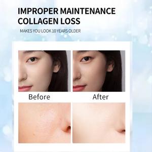 1KG özel etiket toptan kore cilt bakımı Anti Aging kollajen Niacinamide C vitamini E cilt bakımı yüz Serum yüz beyaz - Product Image 6