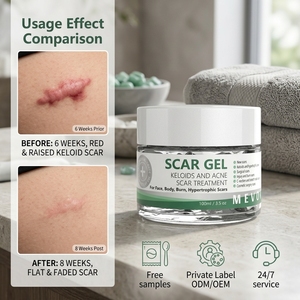 Gel <span class=keywords><strong>para</strong></span> <span class=keywords><strong>Cicatrices</strong></span>, Reparación de Queloides y <span class=keywords><strong>Cicatrices</strong></span> de Acné <span class=keywords><strong>para</strong></span> Rostro y Cuerpo, Mejora <span class=keywords><strong>Cicatrices</strong></span> <span class=keywords><strong>Quirúrgicas</strong></span>, de Quemaduras, Cesáreas e Hipertróficas - Product Image 1