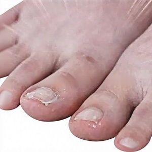 Sérum pour la santé des ongles, pour protéger les ongles sujettes aux problèmes de champignons, sérum coréen pour ongles aux ingrédients naturels - Product Image 4