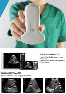 Sonda de ultrasonido inalámbrica para Android, portátil, USB y <span class=keywords><strong>WIFI</strong></span>, a Color - Product Image 3