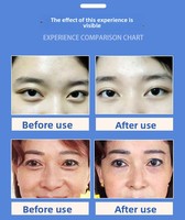 Appareil facial à microcourant BIO pour l'importation d'ions, rajeunissement de la peau, blanchiment, lifting des paupières, électroporation visage et corps