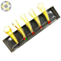 Modèle dentaire de mandibule en PVC pour formation médicale, taille réelle, évolution pathologique des dents, caries, périostite, sciences médicales