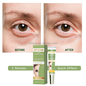 OTVENA Crème Contour des Yeux Raffermissante et Booster d'Éclat à l'Acide Hyaluronique, Beurre de Karité et <span class=keywords><strong>Aloe</strong></span> <span class=keywords><strong>Vera</strong></span> – Réduit Rides, Ridules et <span class=keywords><strong>Cernes</strong></span> - Product Image 3
