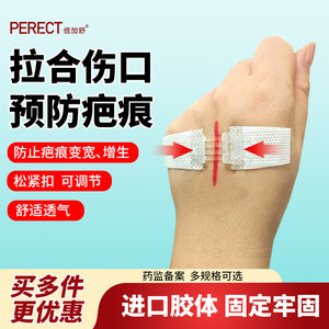 PERECT Bandage élastique à fermeture éclair pour pansement, usage médical, dispositif de réduction de la tension cutanée - Product Image 2