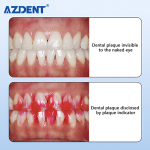 Azdent Chất lượng cao mảng bám tiết lộ đại lý bằng miệng cao răng kiểm tra kiểm tra răng chỉ số mảng bám 5ml - Product Image 6