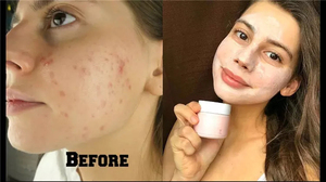<span class=keywords><strong>Mascarilla</strong></span> Facial <span class=keywords><strong>de</strong></span> <span class=keywords><strong>Arcilla</strong></span> <span class=keywords><strong>Rosa</strong></span> Purificante <span class=keywords><strong>de</strong></span> Poros Control <span class=keywords><strong>de</strong></span> Grasa <span class=keywords><strong>Mascarilla</strong></span> Facial en Polvo <span class=keywords><strong>Rosa</strong></span> - Product Image 6