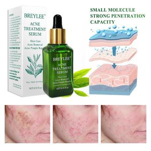BREYLEE tea tree acné traitement acné enlèvement sérum livraison gratuite - Product Image 2