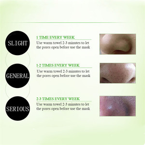 OEM Đen <span class=keywords><strong>Peel</strong></span> Off <span class=keywords><strong>Mask</strong></span> Làm Sạch Mụn Đầu Đen Remover Làm Sạch Sâu Than Tre Mặt Nạ Đen Cho Mụn Sẹo Blemishes - Product Image 4