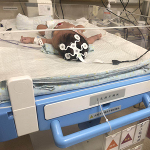Greentek المتاح إيغ القطب صفيف ل aEEG في وحدة العناية المركزة لحديثي الولادة (NICU) - Product Image 4