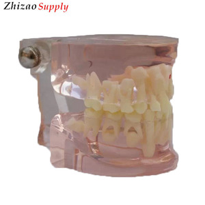 Claire dentaire D'âges Mixtes Modèle de Dentition avec Caries - Product Image 2