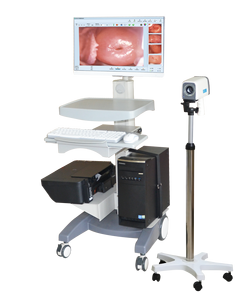 Produsen China Kolposkop Video Digital Vagina Full HD - Product Image 1