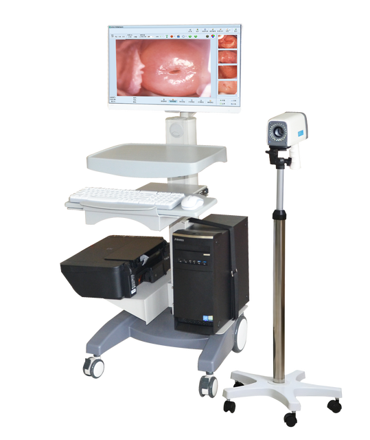 China Manufacturers Full HD Vagina Digital Video Colposcope