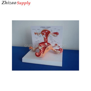 Normal y patológico de ovario enfermo útero modelo anatómico - Product Image 1