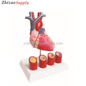 Corazón humano adjuntar arteria vas sangre nave modelo de anatomía - Product Image 2