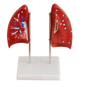 Gelsonlab HSBM-241 मानव फेफड़ों मॉडल फेफड़ों शरीर रचना विज्ञान मॉडल - Product Image 2