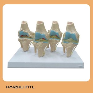 4 Delen Menselijk Plastic Ziek Knieskeletmodel, 4-traps Menselijk Kniegewrichtsmodel - Product Image 4