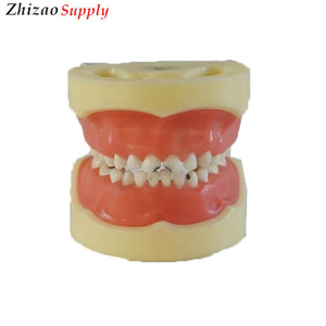Dental niño Caries en los dientes <span class=keywords><strong>de</strong></span> modelo - Product Image 1