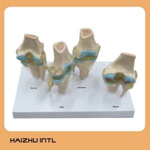 4 Delen Menselijk Plastic Ziek Knieskeletmodel, 4-traps Menselijk Kniegewrichtsmodel - Product Image 3