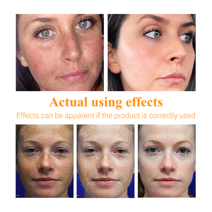 LANBENA Serum Vitamin C Tự Nhiên Làm Sáng Da Công Thức Nhật Bản - Product Image 5