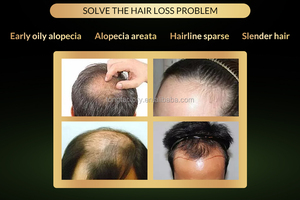 BALALA Venta caliente Crecimiento rápido Esencia del cabello Erupción Producto grueso Extracto 100% natural Efectivo - Product Image 5